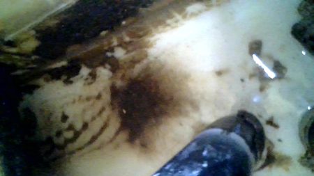 Material in the bottom was not calcified, it was staining